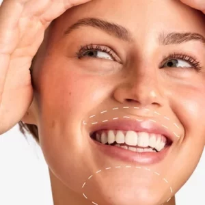 lip laser