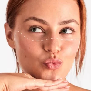 face laser